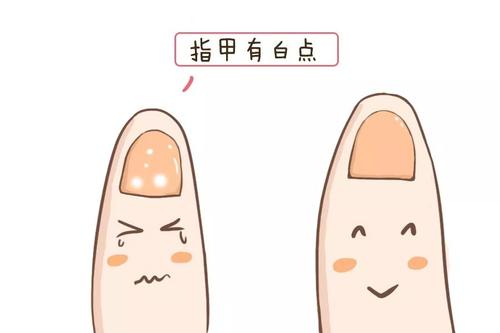 黄瓜视频色板品牌告訴你指甲上有白點是缺哪種微量元素