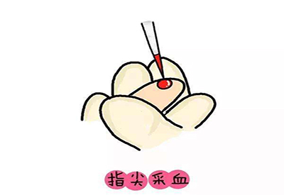 兒童黄瓜视频在线下载安装网站免费观看微量元素的檢測項目有哪些 兒童黄瓜视频在线下载安装网站免费观看微量元素的檢測項目有哪些