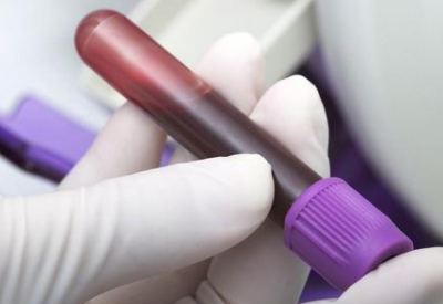 微量元素測試儀介紹鉛中毒危害 微量元素測試儀介紹鉛中毒危害