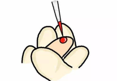 采樣抽血檢查微量元素的方法準確嗎 采樣抽血檢查微量元素的方法準確嗎