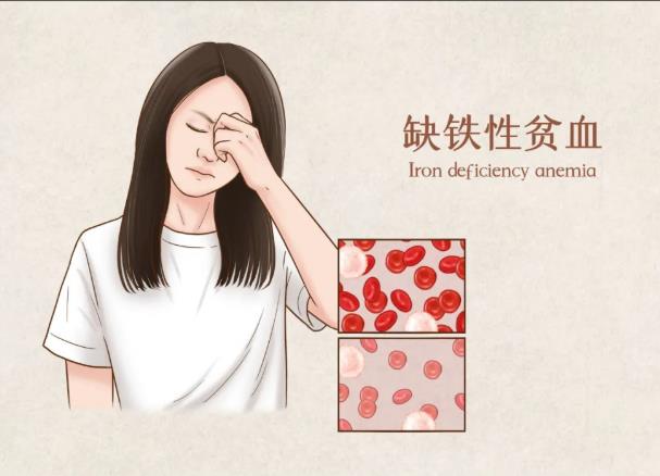 微量元素測試儀品牌-山東國康gk-缺鐵性貧血到底是怎麽回事?如何預防?